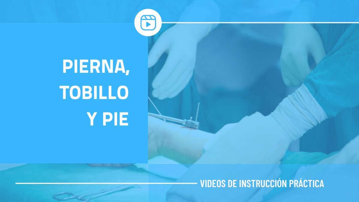 PIERNA, TOBILLO Y PIE