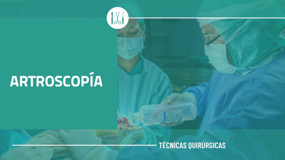 ARTROSCOPÍA
