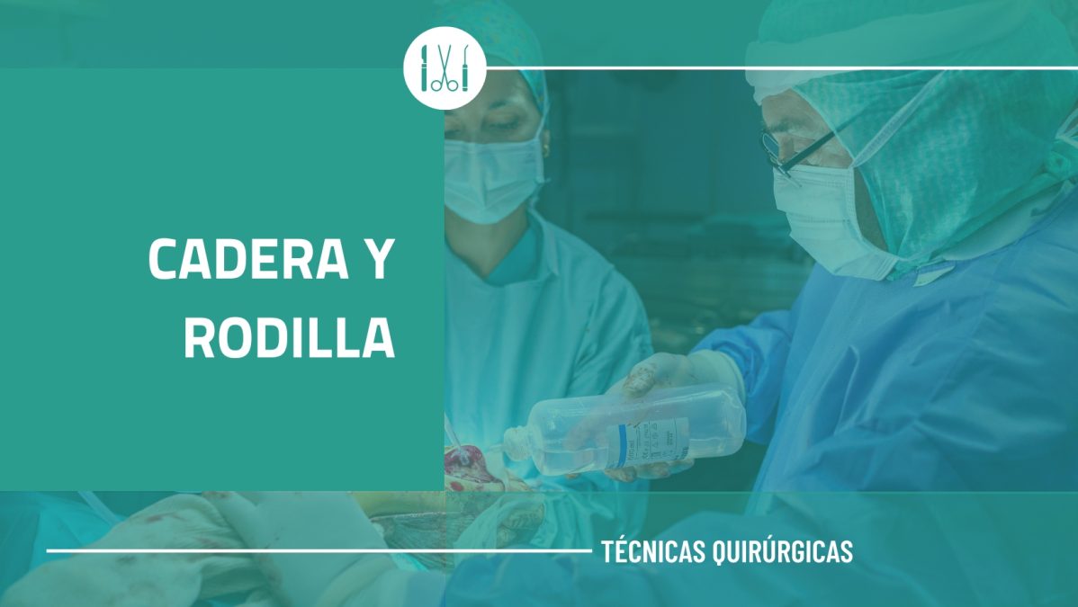 CADERA Y RODILLA