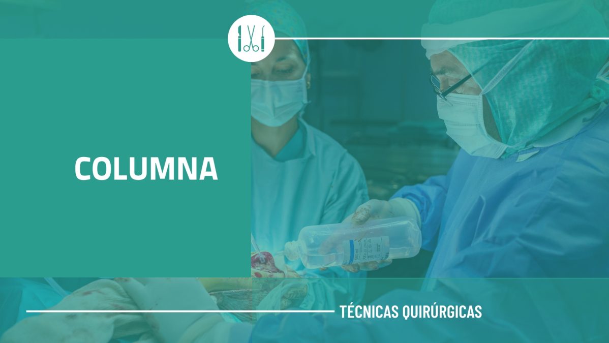 COLUMNA