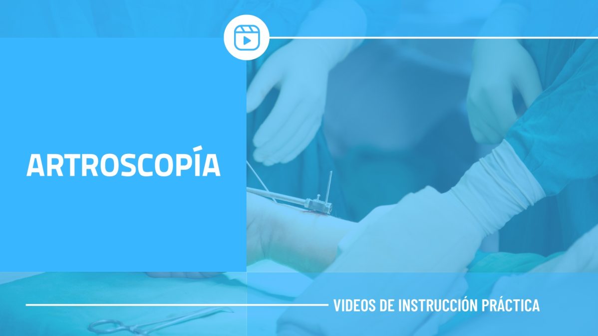 ARTROSCOPÍA