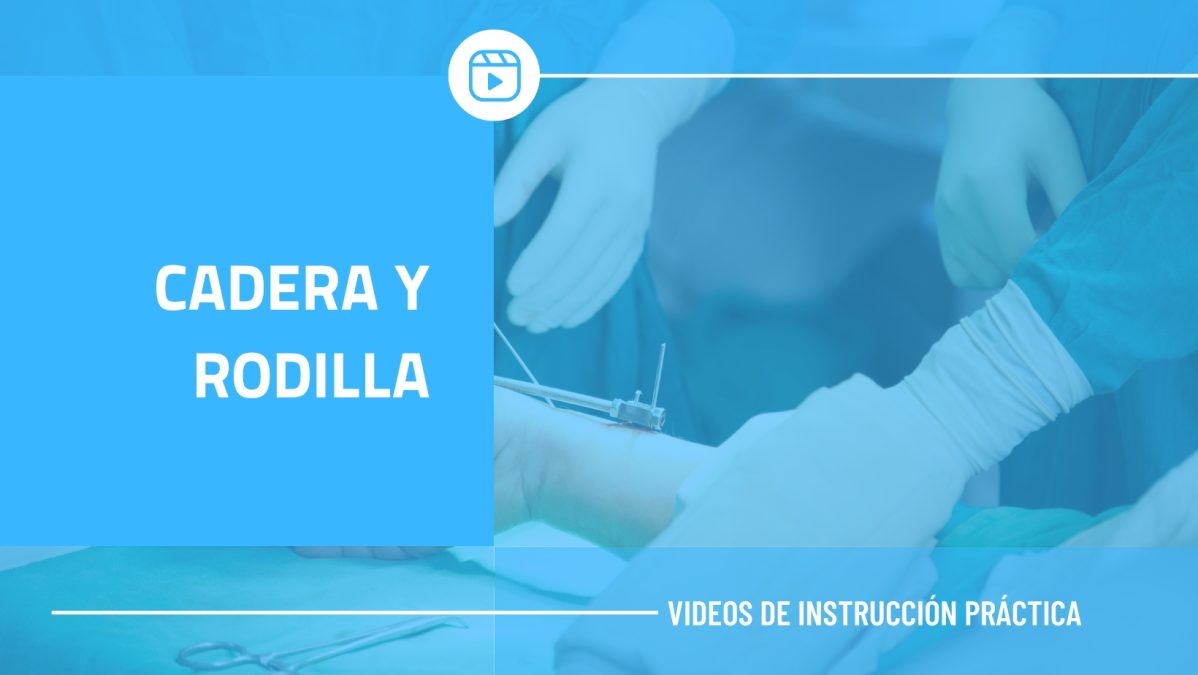 CADERA Y RODILLA