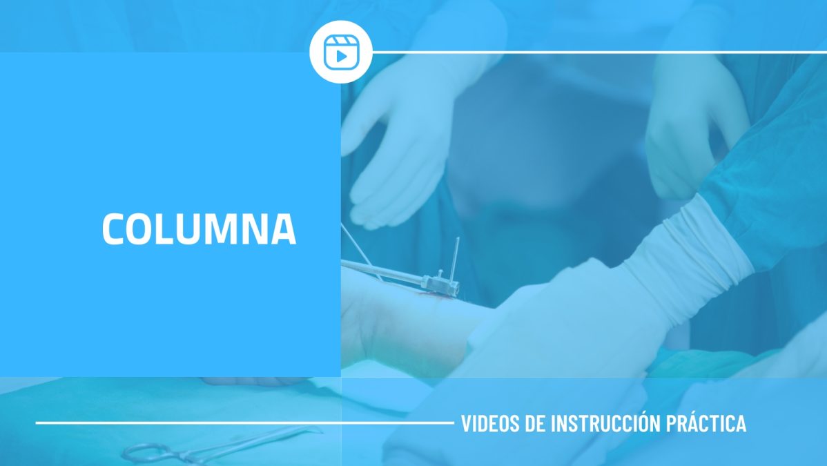 COLUMNA
