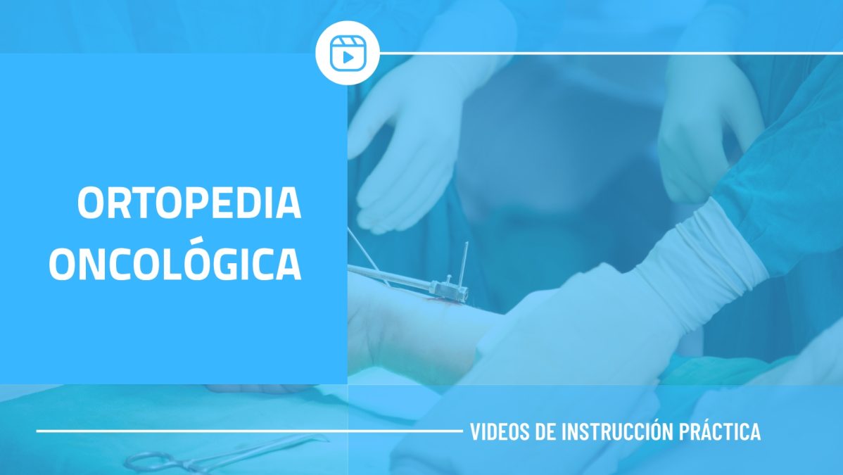 ORTOPEDIA ONCOLÓGICA